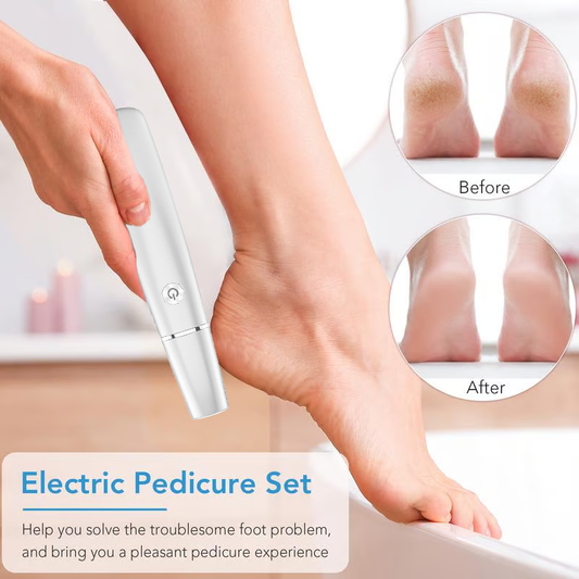 🌸Fête des mères vente chaude 50% RÉDUCTION 🌸Extracteur de callosités électrique pour les pieds